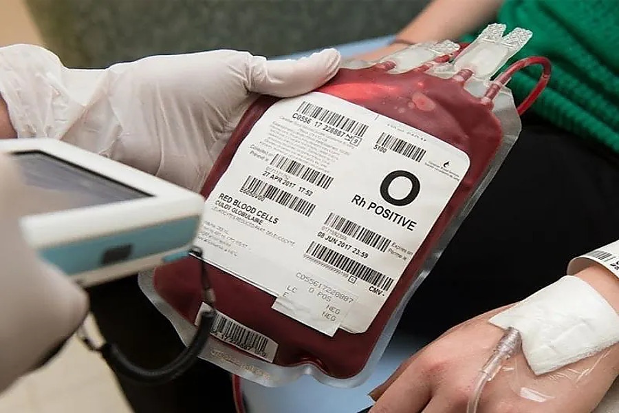 tem-in-nhiet-la-gi-4